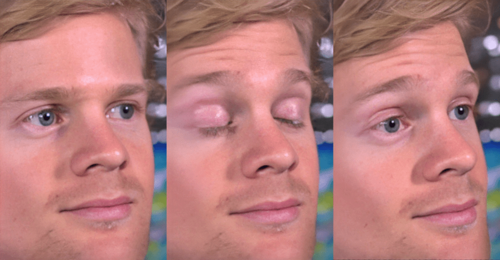 blinking-white-guy-meme-template-drew-scanlon